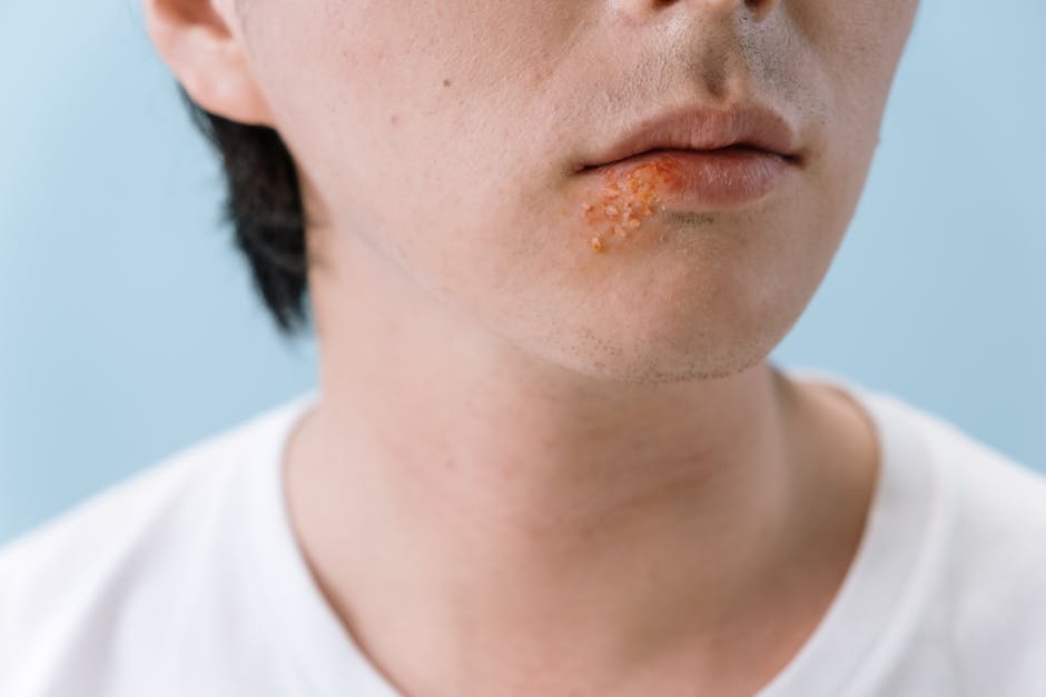 pexels photo 5712684 5712684 A close-up image of a person's lips showing a cold sore on the lower lip area.